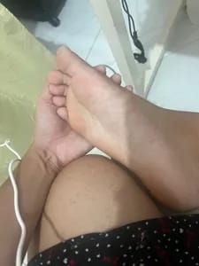 Amputee amputeelunagirl OnlyFans